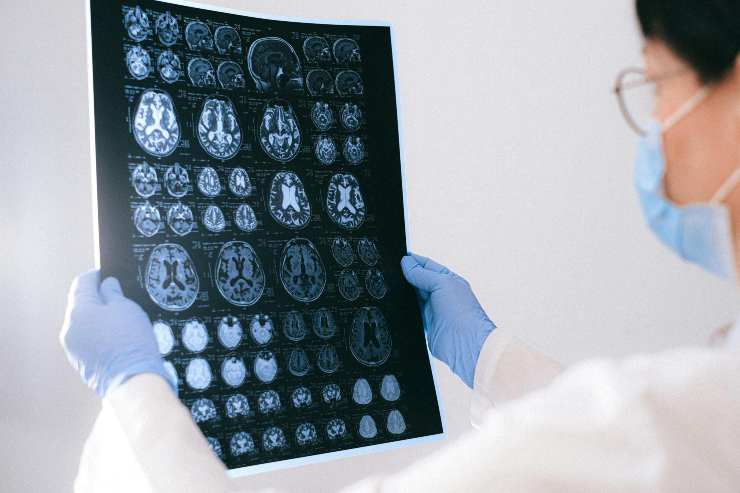 Cervello Salute scienziati rischi grosso segui queste regole