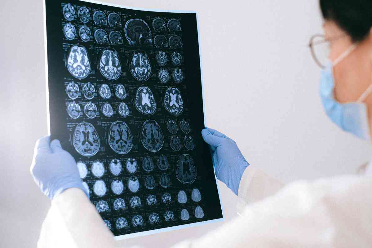 Alzheimer ereditario ruolo ceppo materno studio