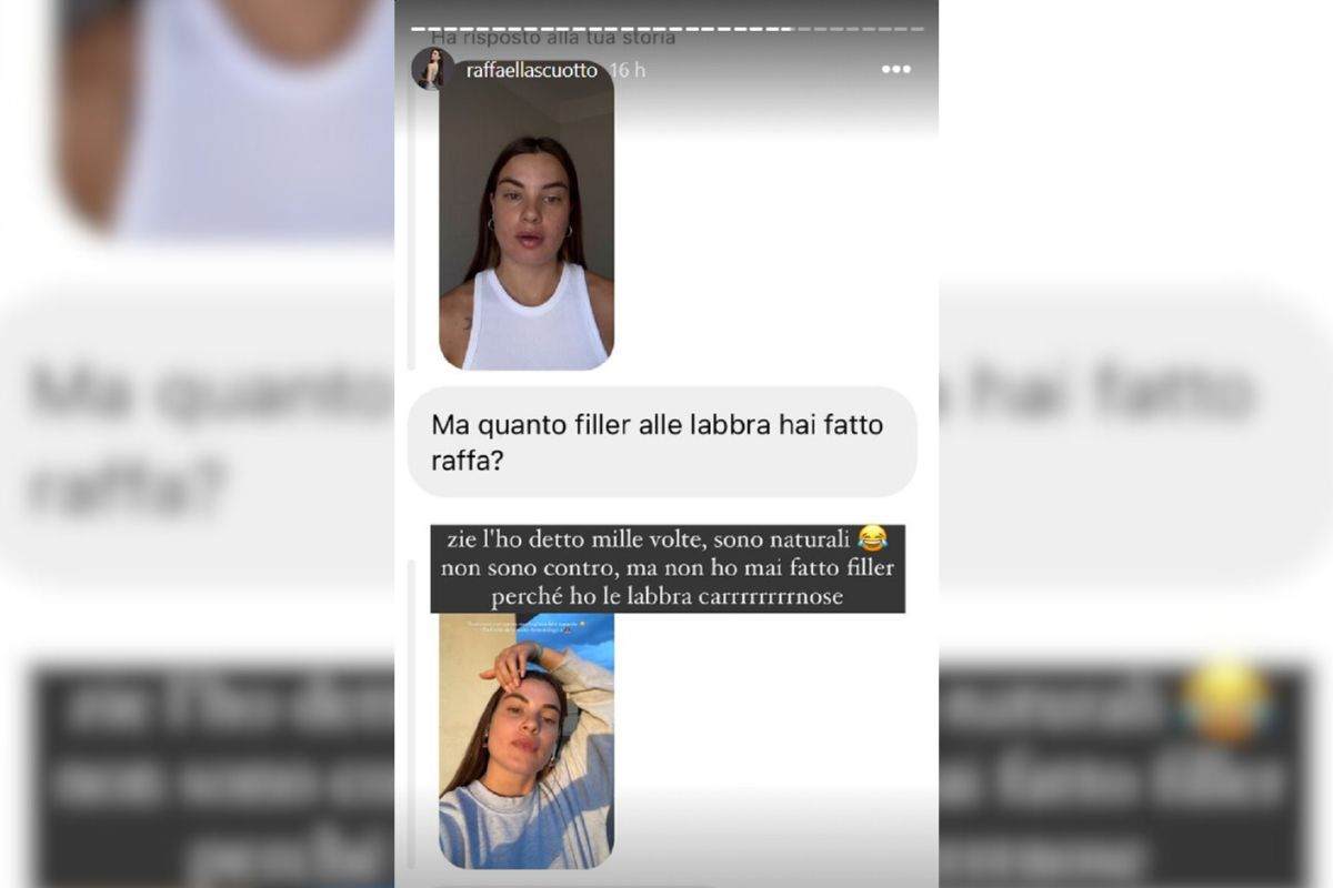 Raffaella Scuotto labbra rifatte